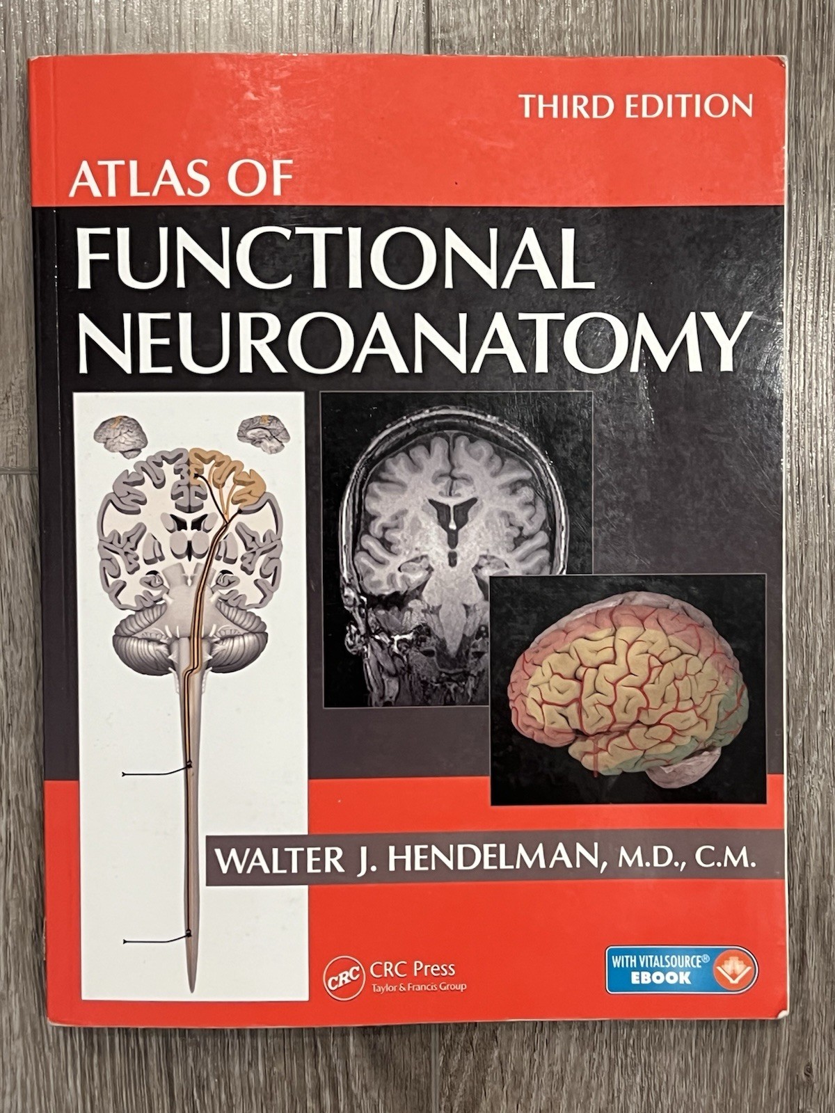Atlas of Functional Neuroanatomy by Hendelman Walter Third Edition Paperback