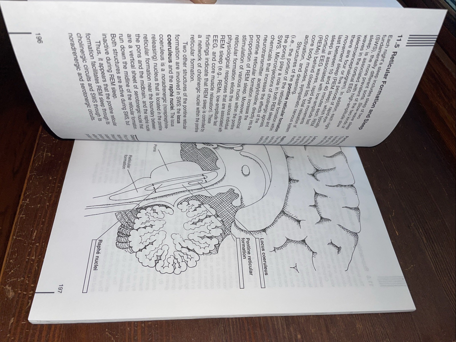 The Anatomy Of The Human Brain, Second Edition