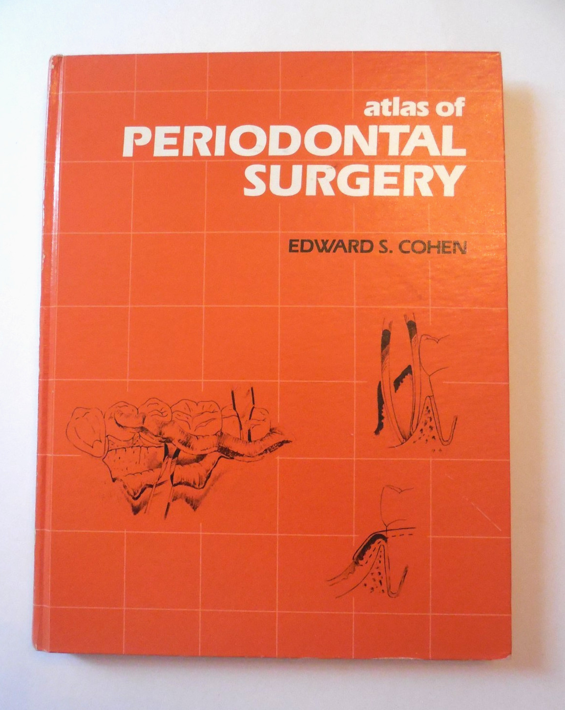 Atlas of Periodontal Surgery by Edward S. Cohen 1988 Hardcover Dentistry