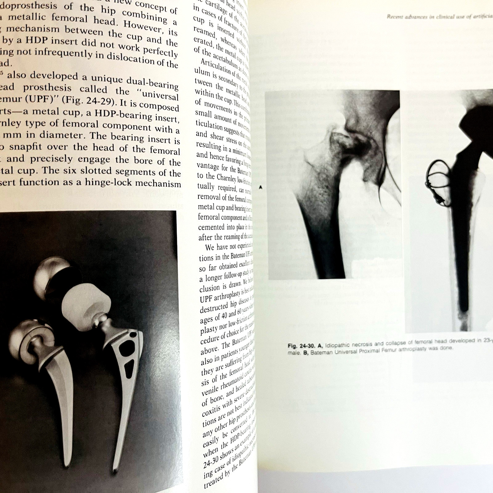 Vintage Biomaterials in Reconstructive Surgery Book Hardcover 1983